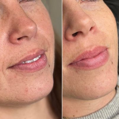 Naturligt permanent makeup læber udført i skønhedssalon nær Ringe